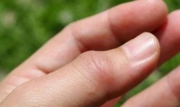 痛风可以吃角瓜吗,角瓜成为健康饮食新选择