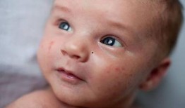 吃蜜瓜嘴肿,甜蜜诱惑下的意外“肿”态